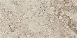 Supernova Stone Pearl 30.5x56 - фото 77712
